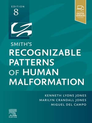 cover image of Smith's Recognizable Patterns of Human Malformation